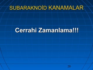 20
SUBARAKNOİDSUBARAKNOİD KANAMALARKANAMALAR
Cerrahi Zamanlama!!!Cerrahi Zamanlama!!!
 