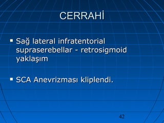42
CERRAHİCERRAHİ
 Sağ lateral infratentorialSağ lateral infratentorial
supraserebellar - retrosigmoidsupraserebellar - retrosigmoid
yaklaşımyaklaşım
 SCA Anevrizması kliplendi.SCA Anevrizması kliplendi.
 