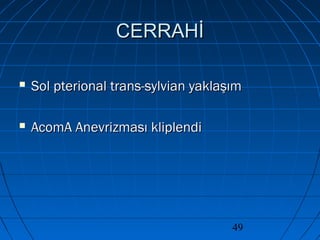 49
CERRAHİCERRAHİ
 Sol pterional trans-sylvian yaklaşımSol pterional trans-sylvian yaklaşım
 AcomA Anevrizması kliplendiAcomA Anevrizması kliplendi
 