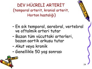 DEV HÜCRELİ ARTERİT
(temporal arterit, kranial arterit,
       Horton hastalığı)


– En sık temporal, serebral, vertebral
  ve oftalmik arteri tutar
– Bazan tüm vücuttaki arterleri,
  bazan aortik arkusu tutar
– Akut veya kronik
– Genellikle 50 yaş sonrası

                                         24
 