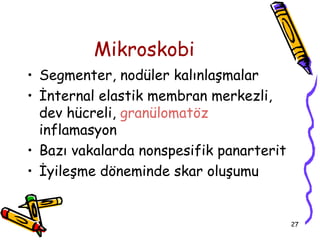 Mikroskobi
• Segmenter, nodüler kalınlaşmalar
• İnternal elastik membran merkezli,
  dev hücreli, granülomatöz
  inflamasyon
• Bazı vakalarda nonspesifik panarterit
• İyileşme döneminde skar oluşumu


                                          27
 