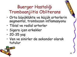 Buerger Hastalığı
 Tromboanjiitis Obliterans
• Orta büyüklükte ve küçük arterlerin
  segmental, trombozan inflamasyonu
• Tibial ve radial arterler
• Sigara içen erkekler
• 20-35 yaş
• Ven ve sinirler de sekonder olarak
  tutulur

                                        49
 