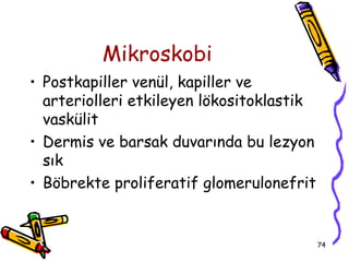 Mikroskobi
• Postkapiller venül, kapiller ve
  arteriolleri etkileyen lökositoklastik
  vaskülit
• Dermis ve barsak duvarında bu lezyon
  sık
• Böbrekte proliferatif glomerulonefrit


                                           74
 