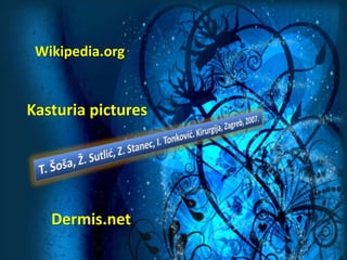 Kasturia pictures
Dermis.net
Wikipedia.org
 