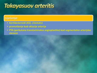 Liječenje:
• Kortikosteroidi (KS), citostatici
• premoštenje kod okluzije arterije
• PTA (perkutana transluminalna angioplastika) kod segmentalne arterijske
stenoze
 