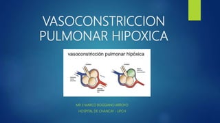 VASOCONSTRICCION
PULMONAR HIPOXICA
MR 3 MARCO BOGGIANO ARROYO
HOSPITAL DE CHANCAY - UPCH
 