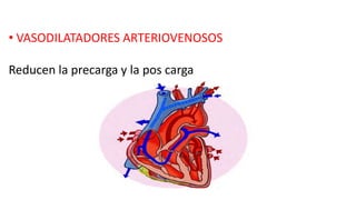 • VASODILATADORES ARTERIOVENOSOS
Reducen la precarga y la pos carga
 
