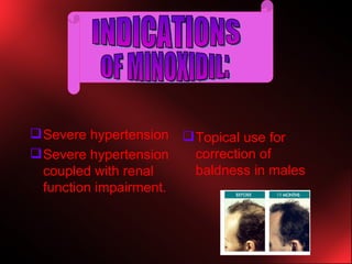 Severe hypertension Severe hypertension coupled with renal function impairment. Topical use for correction of baldness in males OF MINOXIDIL: INDICATIONS 