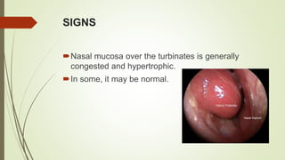 Vasomotor rhinitis and other rhinitis | PPTX