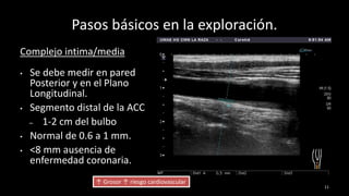 Pasos básicos en la exploración.
Complejo intima/media
• Se debe medir en pared
Posterior y en el Plano
Longitudinal.
• Segmento distal de la ACC
– 1-2 cm del bulbo
• Normal de 0.6 a 1 mm.
• <8 mm ausencia de
enfermedad coronaria.
11
↑ Grosor ↑ riesgo cardiovascular
 
