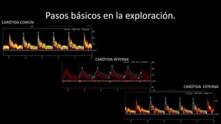 Pasos básicos en la exploración.
15
CARÓTIDA COMÚN
CARÓTIDA INTERNA
CARÓTIDA EXTERNA
 