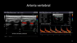 Arteria vertebral
18
 