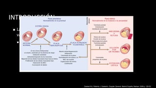 INTRODUCCIÓN
◼ La aterosclerosis es la principal causa de enfermedad
vascular.
◼ Cambios en las capas intima y media resultado de la
acumulación de lípidos y depósitos de Ca++ en la pared del
vaso.
❖ Lesiones tempranas → Estrías grasas
❖ Etapas tardías → Placas fibrosas o ateroscleróticas
Zwiebel WJ, Pellerito J. Zwiebel’s, Doppler General. Madrid España: Marban; 2008 p. 129-52.
 