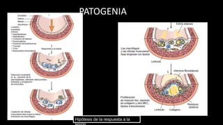 PATOGENIA
Hipótesis de la respuesta a la
 