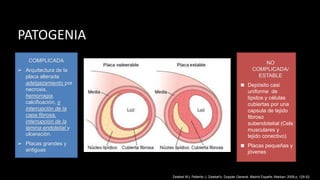 PATOGENIA
NO
COMPLICADA/
ESTABLE
◼ Depósito casi
uniforme de
lípidos y células
cubiertas por una
capsula de tejido
fibroso
subendotelial (Cels
musculares y
tejido conectivo)
◼ Placas pequeñas y
jóvenes
COMPLICADA
➢ Arquitectura de la
placa alterada
adelgazamiento por
necrosis,
hemorragia,
calcificación, o
interrupción de la
capa fibrosa,
interrupción de la
lamina endotelial y
ulceración.
➢ Placas grandes y
antiguas
Zwiebel WJ, Pellerito J. Zwiebel’s, Doppler General. Madrid España: Marban; 2008 p. 129-52.
 