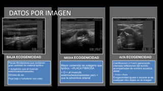 DATOS POR IMAGEN
Placas fibrolipídicas que contienen
gran cantidad de material lipídico
< ecogénico que el musculo
esternocleidomastoideo.
Difíciles de ver
Flujo bajo o turbulento con color.
BAJA ECOGENICIDAD
Mayor contenido de colágeno que
lipídico →PLACA FIBROSA
> O = al musculo
esternocleidomastoideo pero <
que la adventicia arterial
MEDIA ECOGENICIDAD
Calcificación (<1mm) generando
intensas reflexiones del sonido
acompañadas de sombra acústica
distal.
• Focal o difusa
Ecogenicidad iguala o excede la de
cualquier otro objeto en la imagen
ALTA ECOGENICIDAD
 