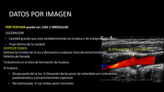 DATOS POR IMAGEN
POR TEXTURA puede ser: LISA O IRREGULAR
ULCERACION
• Cavidad grande que esta verdaderamente en la placa y de márgenes abruptos
• Flujo dentro de la cavidad
DOPPLER PODER
Delinea los limites de la luz y demuestra cualquier área de estrechamiento.
Defecto de llenado.
Turbulencia en el área de formación de la placa
Si la placa:
• Ocupa parte de la luz → Elevación de los picos de velocidad con turbulencia
postestenotica y ensanchamiento espectral.
• No estenosada → Las ondas serán normales.
 