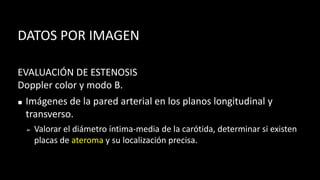 DATOS POR IMAGEN
EVALUACIÓN DE ESTENOSIS
Doppler color y modo B.
◼ Imágenes de la pared arterial en los planos longitudinal y
transverso.
➢ Valorar el diámetro íntima-media de la carótida, determinar si existen
placas de ateroma y su localización precisa.
 