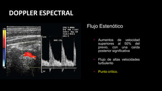 • Aumentos de velocidad
superiores al 50% del
previo, con una caída
posterior significativa
• Flujo de altas velocidades
turbulento
• Punto crítico.
Flujo Estenótico
DOPPLER ESPECTRAL
 