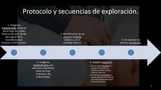 1. Imágenes
transversales desde la
parte baja del cuello
hacia arriba por detrás
del ángulo de la
mandíbula para
localizar la bifurcación.
2. Imágenes
longitudinales con
color para identificar
áreas de flujo
anómalo y de
enfermedad.
3. Identificación de las
arterias carótida
externa y de la
carótida interna.
4. Doppler espectral:
• En los vasos normales se
toman lecturas de las
arterias carótida común,
interna y externa.
• En los vasos anómalos se
toman lecturas de las zonas
de enfermedad además de
lecturas de rutina.
5. Se exploran las
arterias vertebrales.
5
Protocolo y secuencias de exploración.
 