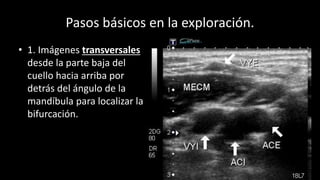 Pasos básicos en la exploración.
6
• 1. Imágenes transversales
desde la parte baja del
cuello hacia arriba por
detrás del ángulo de la
mandíbula para localizar la
bifurcación.
 