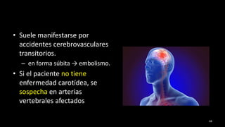 • Suele manifestarse por
accidentes cerebrovasculares
transitorios.
– en forma súbita → embolismo.
• Si el paciente no tiene
enfermedad carotídea, se
sospecha en arterias
vertebrales afectados
68
 