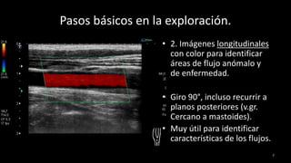 Pasos básicos en la exploración.
7
• 2. Imágenes longitudinales
con color para identificar
áreas de flujo anómalo y
de enfermedad.
• Giro 90°, incluso recurrir a
planos posteriores (v.gr.
Cercano a mastoides).
• Muy útil para identificar
características de los flujos.
 