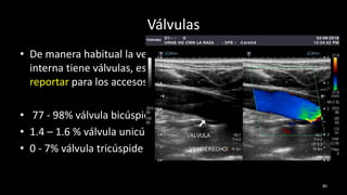 Válvulas
• De manera habitual la vena yugular
interna tiene válvulas, es importante
reportar para los accesos venosos.
• 77 - 98% válvula bicúspide
• 1.4 – 1.6 % válvula unicúspide
• 0 - 7% válvula tricúspide
80
 