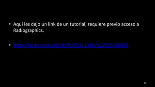 • Aquí les dejo un link de un tutorial, requiere previo acceso a
Radiographics.
• https://pubs.rsna.org/doi/full/10.1148/rg.2019180055
83
 