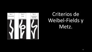 Criterios de
Weibel-Fields y
Metz.
92
 