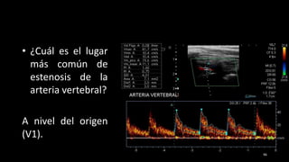 • ¿Cuál es el lugar
más común de
estenosis de la
arteria vertebral?
A nivel del origen
(V1).
96
 