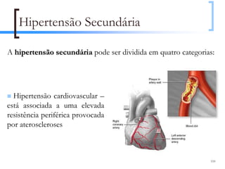 Hipertensão Secundária

A hipertensão secundária pode ser dividida em quatro categorias:




  Hipertensão cardiovascular –
está associada a uma elevada
resistência periférica provocada
por ateroscleroses



                                                              110
 