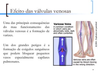 Efeito das válvulas venosas
Uma das principais consequências
do mau funcionamento das
válvulas venosas é a formação de
varizes.

Um dos grandes perigos é a
formação de coágulos sanguíneos
que podem bloquear pequenos
vasos especialmente capilares
pulmonares.

                                   88
 