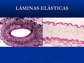 LÁMINAS ELÁSTICAS

 