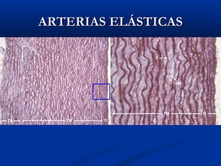 ARTERIAS ELÁSTICAS

 