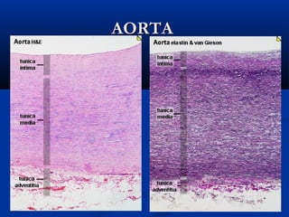 AORTA

 