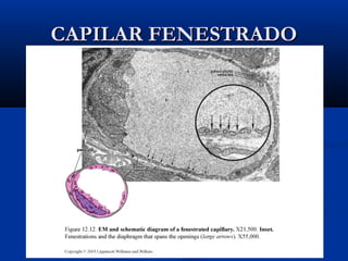 CAPILAR FENESTRADO

 