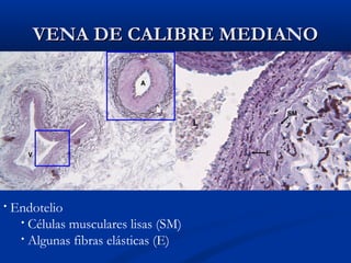 VENA DE CALIBRE MEDIANO

•

Endotelio
• Células musculares lisas (SM)
• Algunas fibras elásticas (E)

 