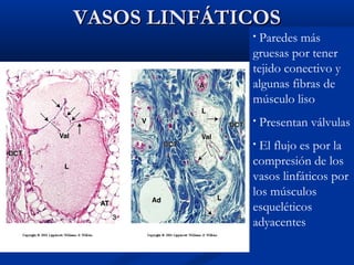 VASOS LINFÁTICOS

Paredes más
gruesas por tener
tejido conectivo y
algunas fibras de
músculo liso
•

•

Presentan válvulas

El flujo es por la
compresión de los
vasos linfáticos por
los músculos
esqueléticos
adyacentes
•

 