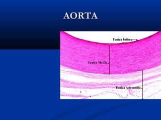 AORTA

 