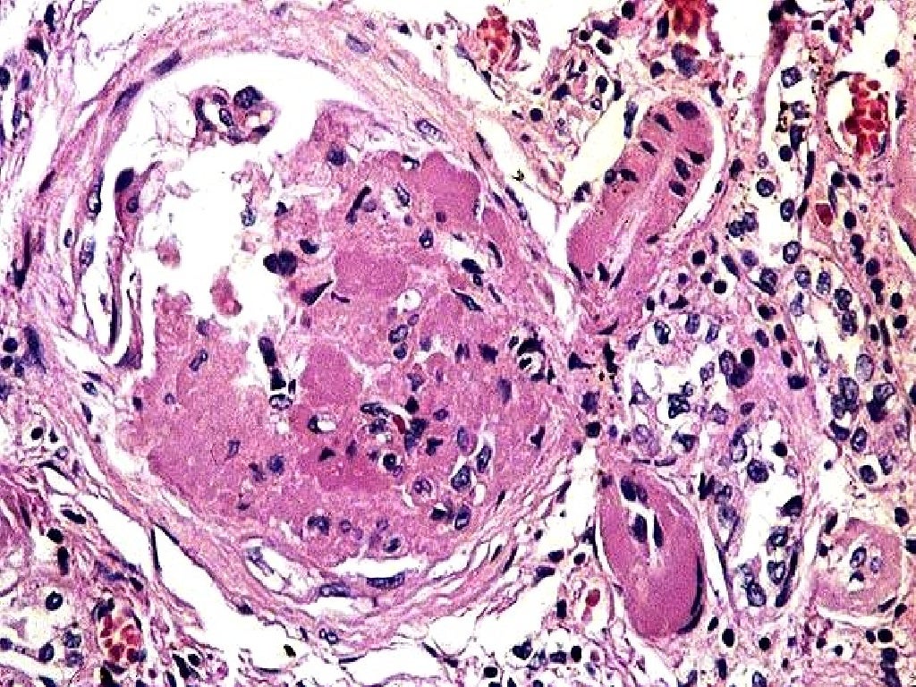 Vasos sanguíneos(2)