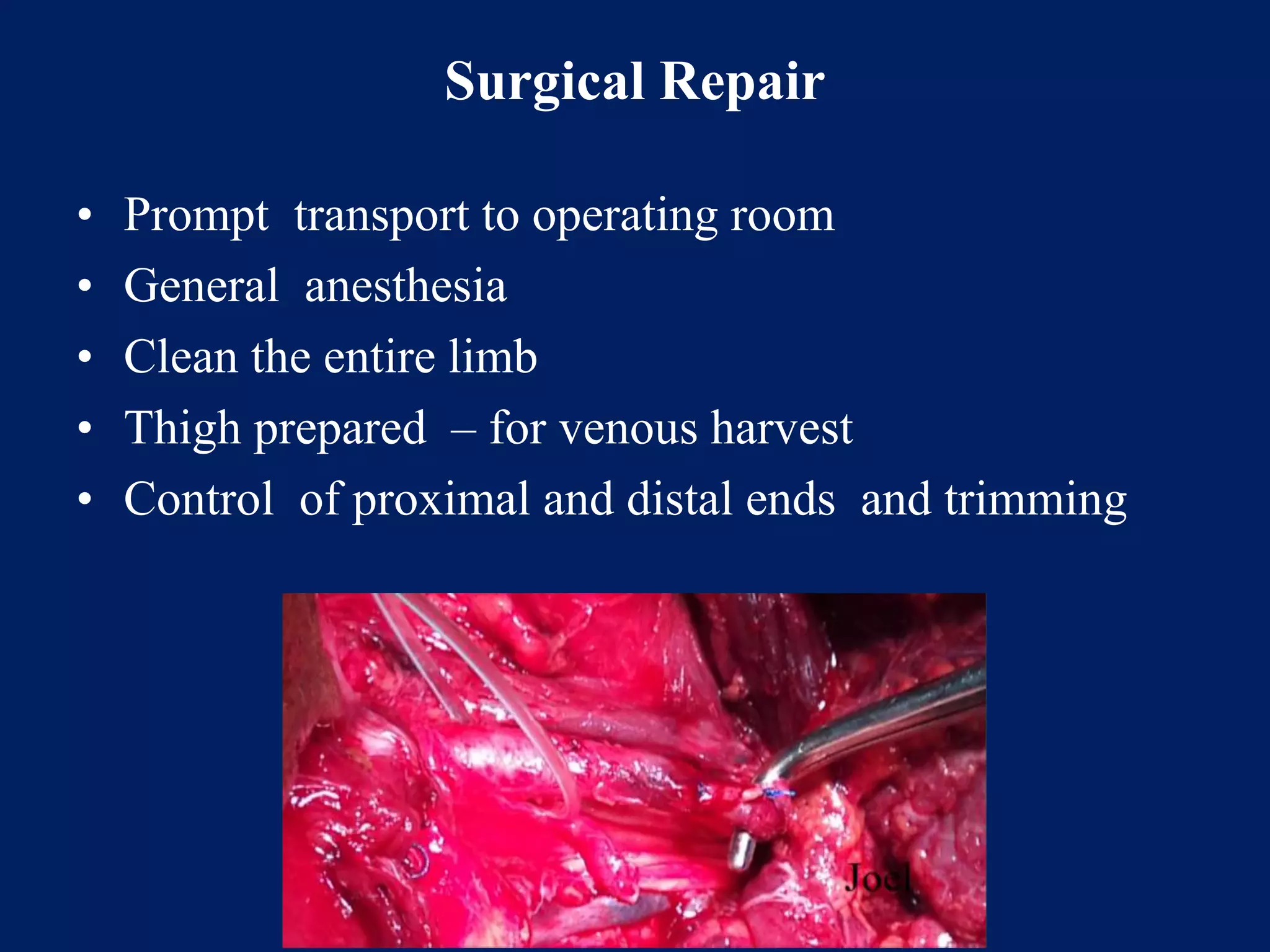 Surgical Repair
• Prompt transport to operating room
• General anesthesia
• Clean the entire limb
• Thigh prepared – for venous harvest
• Control of proximal and distal ends and trimming
 