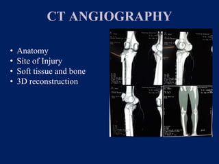 CT ANGIOGRAPHY
• Anatomy
• Site of Injury
• Soft tissue and bone
• 3D reconstruction
 