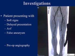 Investigations
• Patient presenting with
– Soft signs
– Delayed presentation
– Avf
– False aneurysm
– Pre-op angiography
 