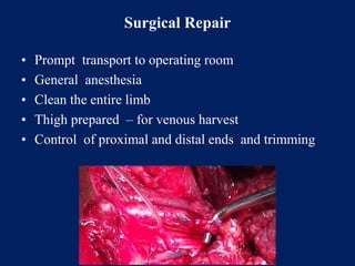 Surgical Repair
• Prompt transport to operating room
• General anesthesia
• Clean the entire limb
• Thigh prepared – for venous harvest
• Control of proximal and distal ends and trimming
 