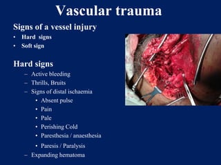 Vascular trauma
Signs of a vessel injury
• Hard signs
• Soft sign
Hard signs
– Active bleeding
– Thrills, Bruits
– Signs of distal ischaemia
• Absent pulse
• Pain
• Pale
• Perishing Cold
• Paresthesia / anaesthesia
• Paresis / Paralysis
– Expanding hematoma
 
