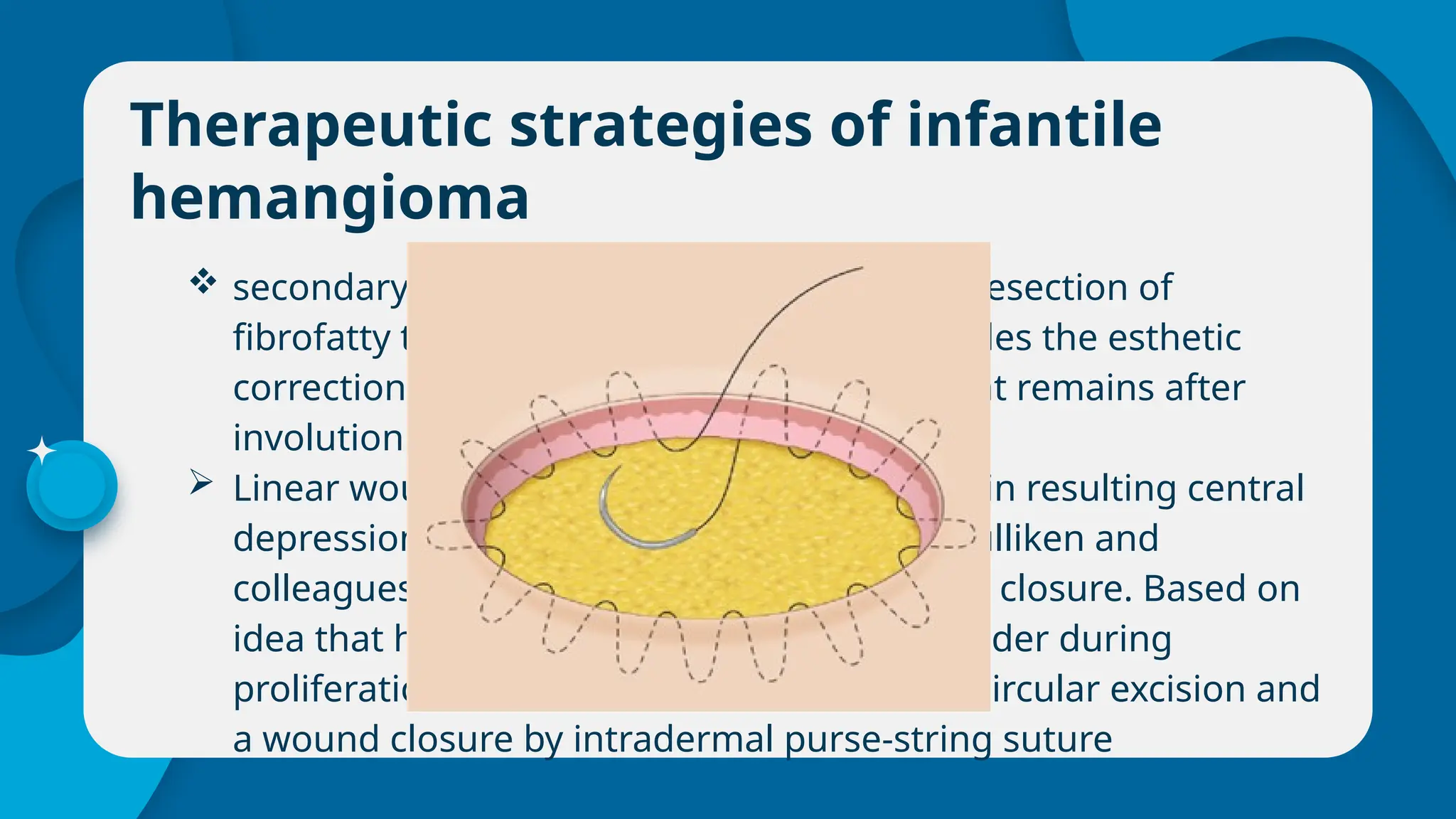 Management of vascular malformations | PPTX