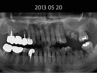 2013 05 20
31
2013 05 20
 