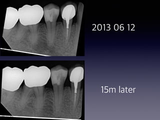 2013 06 12
15m later
 