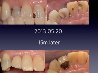 2013 05 20
15m later
 